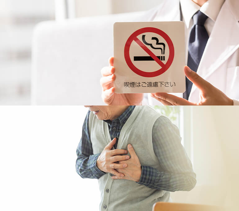 禁煙治療について