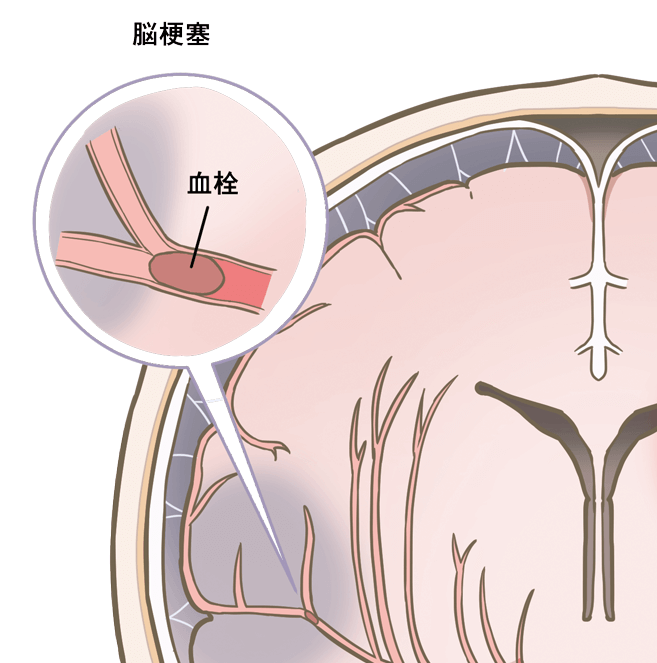 ない 回ら 呂律 が